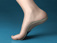 Foot Orthotics 3